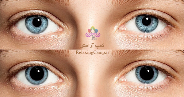 مفهوم تغییرات اندازه مردمک چشم
